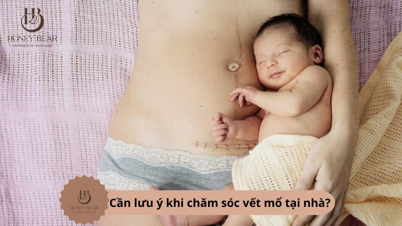 Cần lưu ý khi chăm sóc vết mổ tại nhà?