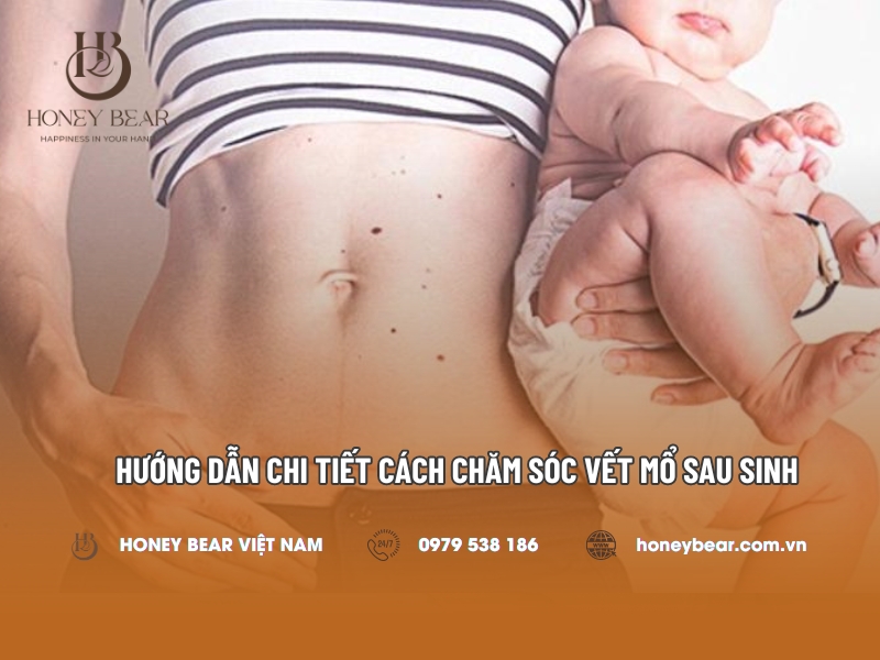 Hướng dẫn chi tiết cách chăm sóc vết mổ sau sinh