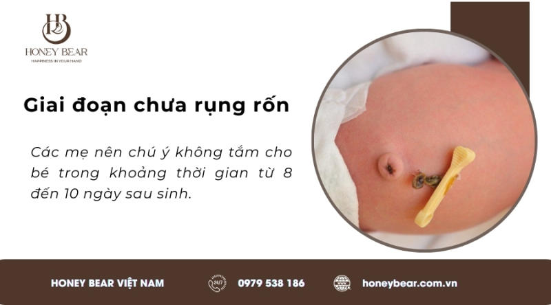 Giai đoạn bé chưa rụng rốn