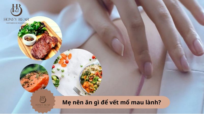 Mẹ nên ăn gì để vết mổ mau lành?