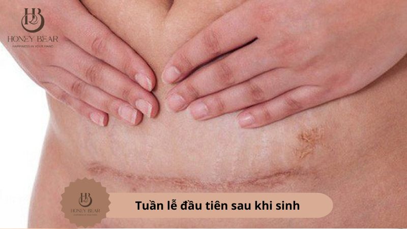 Tuần lễ đầu tiên sau khi sinh