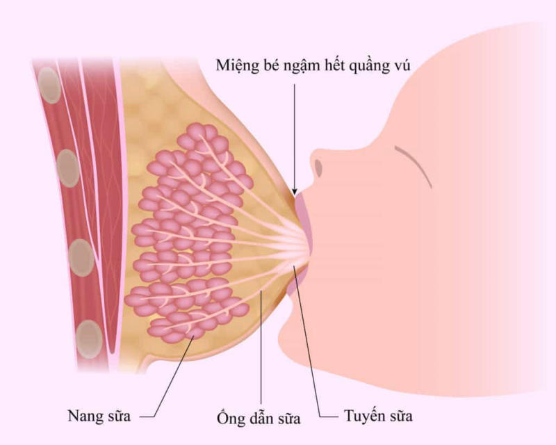 Bé ngậm không đúng khớp ngậm