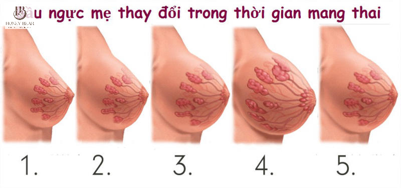 Kích thước ngực sẽ tăng lên khi mang thai